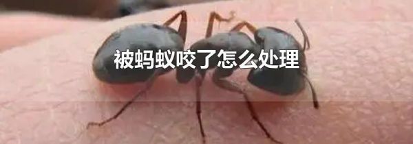 被蚂蚁咬了怎么处理