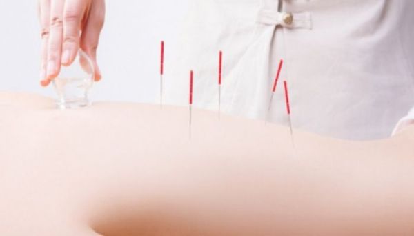 拔罐多久可以洗热水澡  拔罐后需要等多久才能洗澡