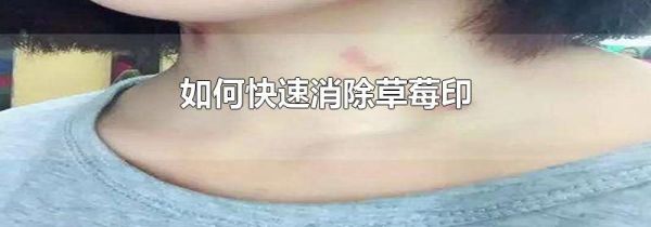 如何快速消除草莓印