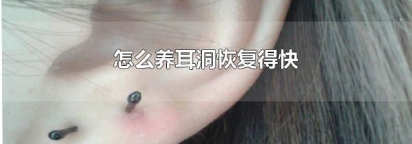 怎么养耳洞恢复得快