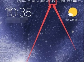 小米14hd设置在哪里关闭