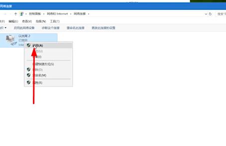 电脑ip配置错误连不上网怎么办