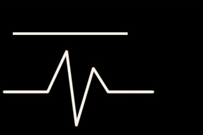 PS怎如何画一条发光的线？PS画一条发光的线教程一览