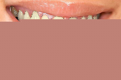 PS牙齿如何变白 变白方法推荐