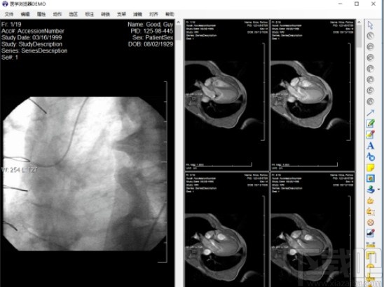 leadtools使用教程